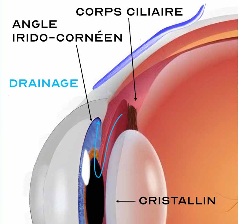 Glaucome